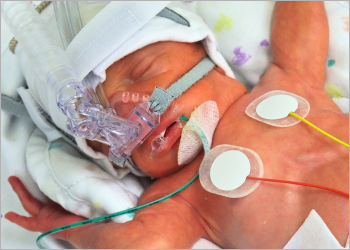 New Evidence Map: Infants and Young Children at Risk for Neurodevelopmental Delay